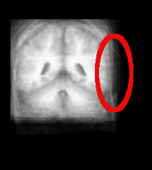 bad_brain_atlas_out-marked