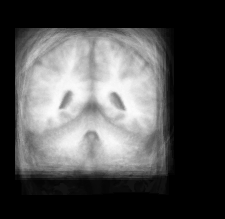 brain_atlas_out
