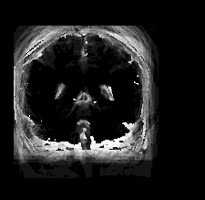 brain_intensity_var_out