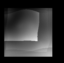 brain_shape_var_out-rigid