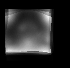 brain_shape_var_out